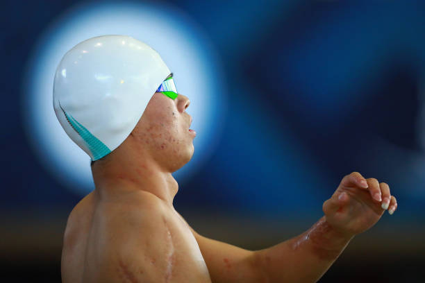 除了紅眼病，男性游泳還會感染這些你想不到的疾病